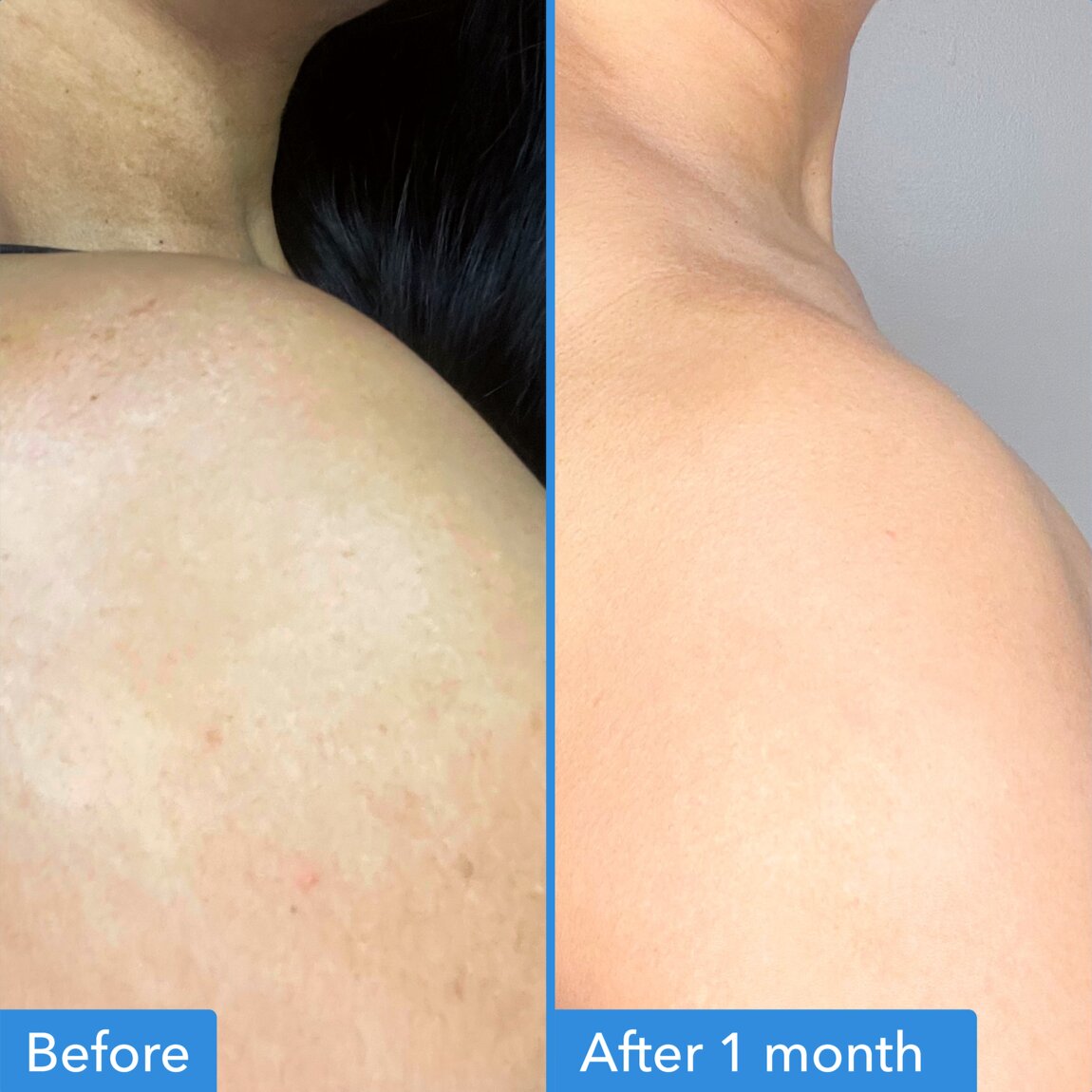 discoloration-correcting-body-treatment-g4 zb_p.jpg