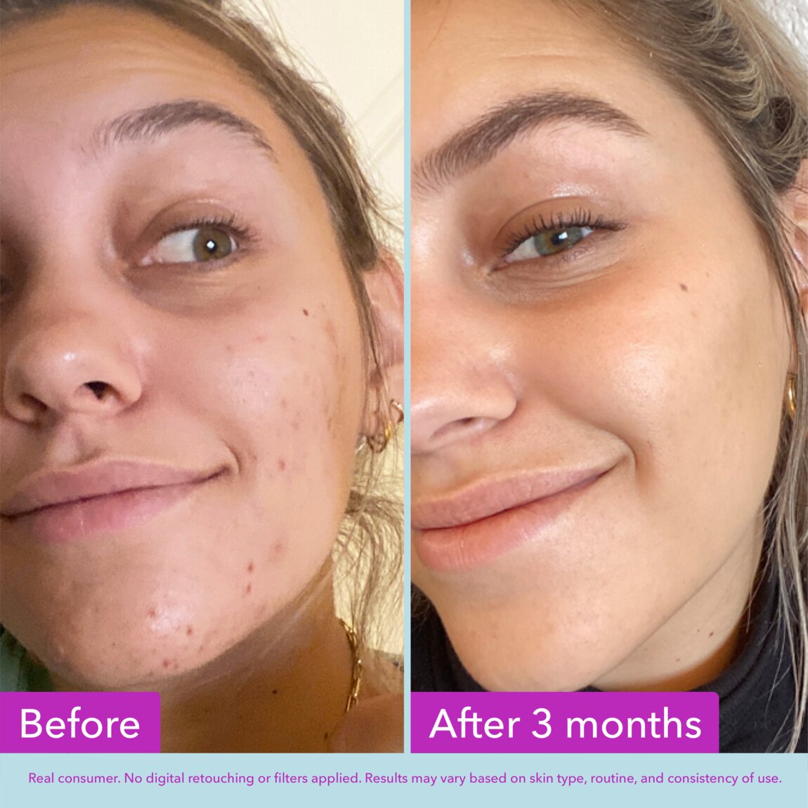niacinamide-brightening-toner-w4 zb_p.jpg