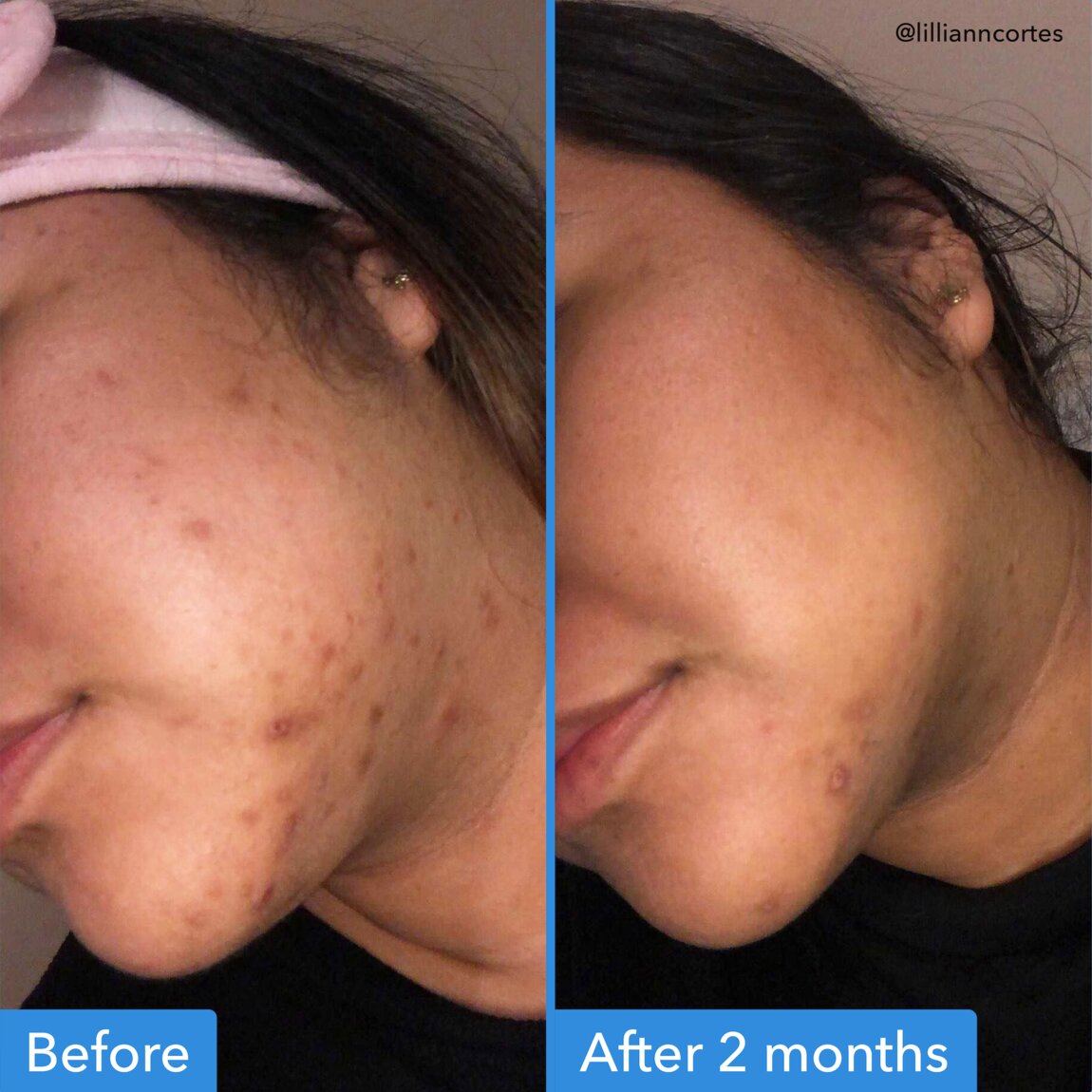discoloration-correcting-serum-c3 zb_p.jpg